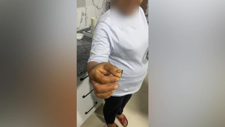 Parmağında sıkışan yüzüğü itfaiye çıkardı