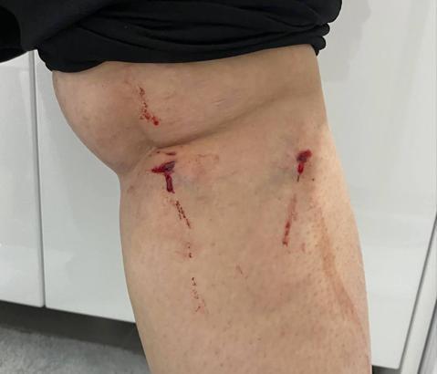 İstanbul - Üniversite kampüsünde köpeklerin saldırına uğradı: O anlar kamerada