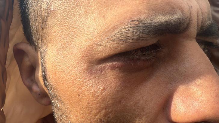 İstanbul - Taksim’de 'Borcunu sileceğiz' yalanıyla alıkonulup darbedildi: 'Şikayetini çek aileni öldürürüz' tehdidi