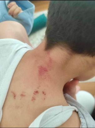 Şanlıurfa'da öğrencisini döven öğretmen tutuklandı