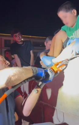 Bahçe duvarına çıkan çocuğun bacağına demir saplandı