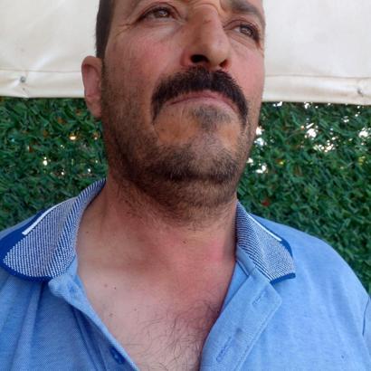 Ayının elinden dakika farkıyla kurtuldu, arı sokması sonucu hastanelik oldu