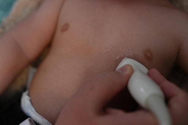 ‘Çocuklarda hipertansiyon gizlice ilerliyor’