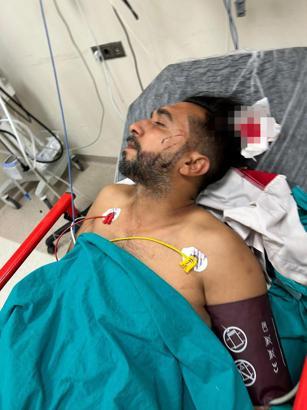 Döner yerken başına kurşun isabet etti