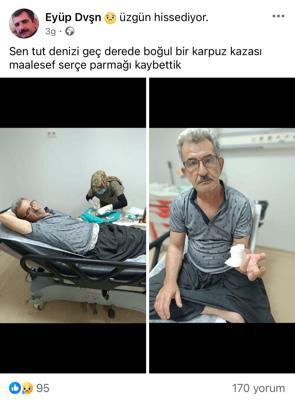 Karpuz keserken parmağını kesti
