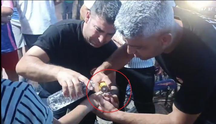 Nusaybin’de 10 yaşındaki çocuğun parmağına sıkışan yüzük kesilerek çıkarıldı