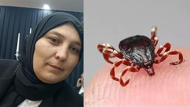 Kayseri'de kenenin ısırdığı 2 çocuk annesi öldü