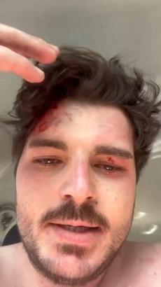 4 kişinin trafikte darbettiği oyuncu: Öldürene kadar döveceklerdi