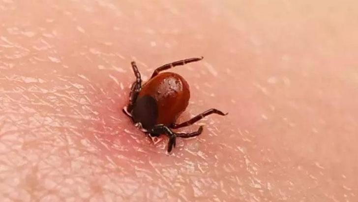 Bolu'da kenenin ısırdığı kadın öldü