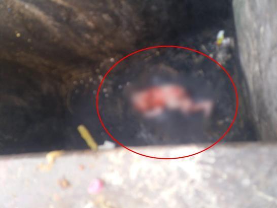 Doğurup çöp konteynerine attığı bebeği esnaf fark etti; anne gözaltında