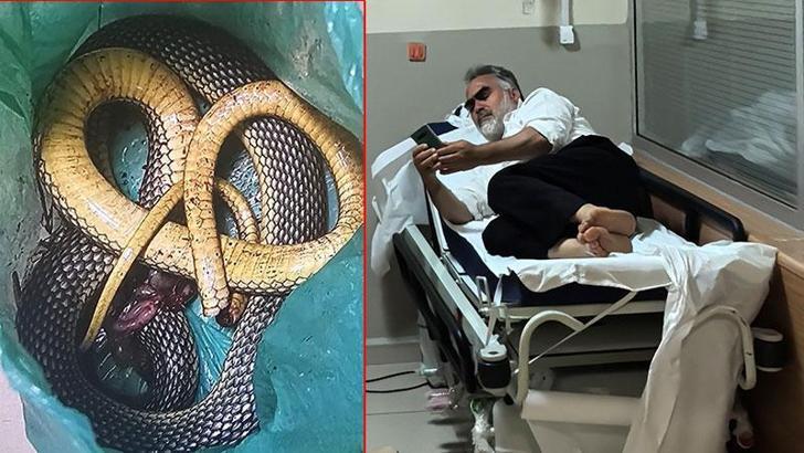 Öldürdüğü bacağını ısıran yılan ile hastaneye gitti