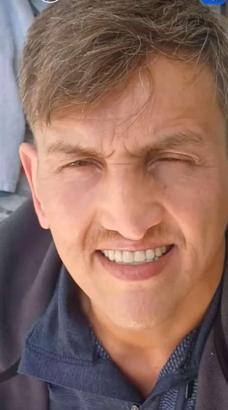 İstanbul - Brezilyalı modelin hayatını kaybettiği hastanede ikinci ölüm; burun ameliyatı sonrası fenalaştı