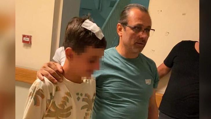 Sokakta oynayarken komşusunun başına şişe attığı çocuk yaralandı