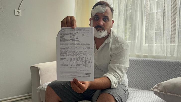 Taksici, eski sözlüsü ve ikizinin polis sevgililerinin kendisini dövdüğünü iddia etti