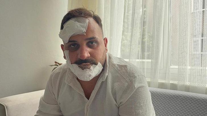 Taksici, eski sözlüsü ve ikizinin polis sevgililerinin kendisini dövdüğünü iddia etti