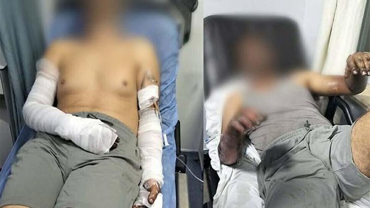 Oto tamirhanesinde patlama; 2 işçi yaralandı