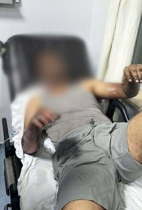 Oto tamirhanesinde patlama; 2 işçi yaralandı