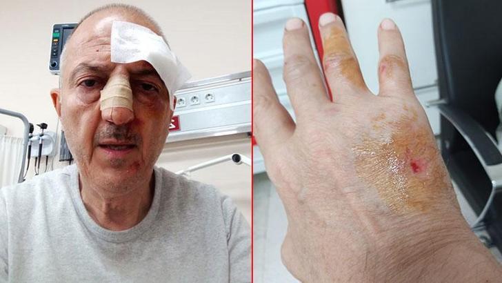 Evden tahliyesi sırasında kendisini darbettiğini öne sürdüğü kayınbiraderinden şikayetçi oldu