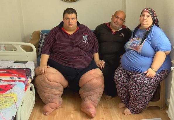 İstanbul - 270 kilo Mehmet: 15 aydır evden çıkamıyorum, yardım edin
