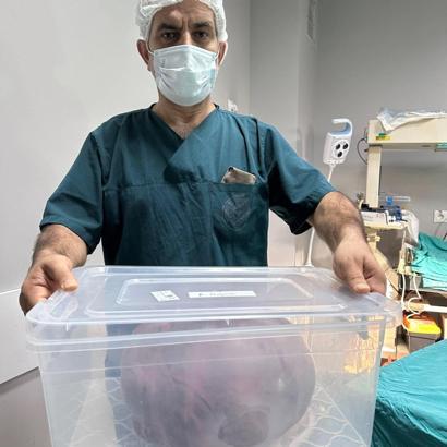 Yumurtalıklarındaki 9 kiloluk kitle operasyonla çıkarıldı