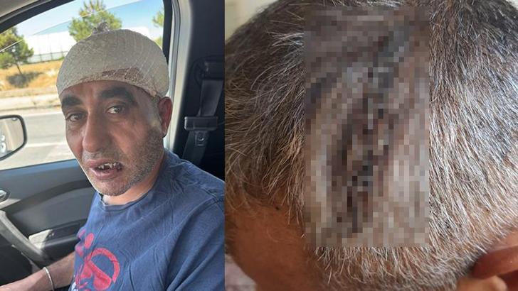 Eğlence mekanında darbedildiği iddiasıyla şikayetçi oldu