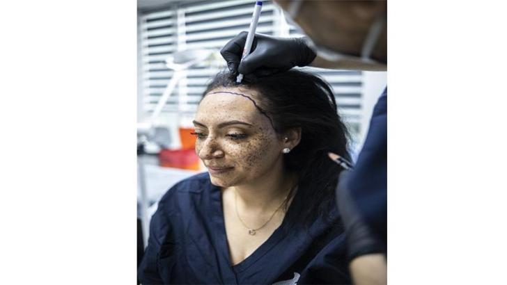 ‘Kadınlarda saç dökülmesi genetikle sınırlı değil; stres, beslenme ve hormonal dengesizlikler de büyük rol oynuyor’