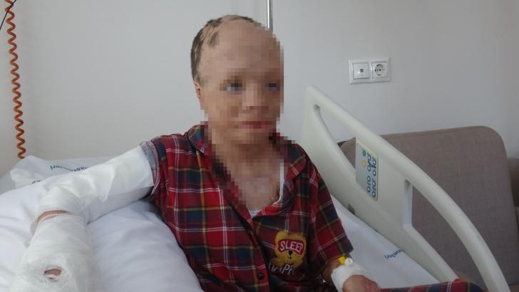 Babası ve 3 kardeşinin öldüğü yangında yaralanan Eymen, artık bir elini kullanabilecek