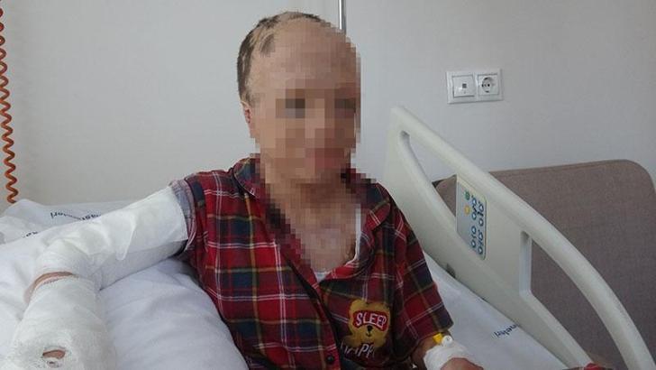 Babası ve 3 kardeşinin öldüğü yangında yaralanan Eymen, artık bir elini kullanabilecek