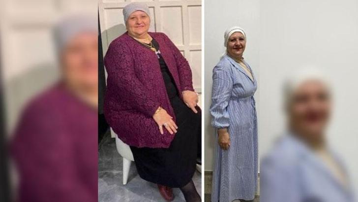 54 yaşındaki Hatice Yıldırım, 1 yılda 35 kilo verdi