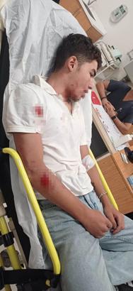 Ankara'da 14 yaşındaki Kenan Efe 'ne bakıyorsun' kavgasında hastanelik oldu