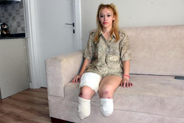 Evlilik yıl dönümünde bacaklarını kaybetti