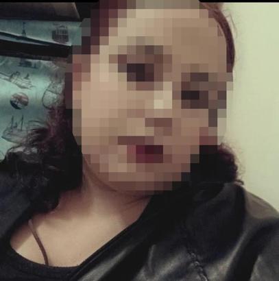 3,5 yaşındaki çocuğu darbedip, vücudunda sigara söndüren anne ve sevgilisi tutuklandı (2)