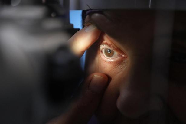 Görme kaybı yaşayan hasta, tedaviyle sağlığına kavuştu