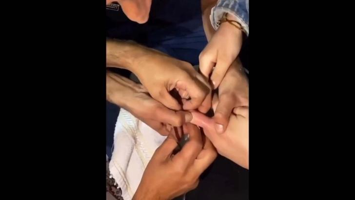 Parmağına sıkışan yüzüğü itfaiye çıkardı