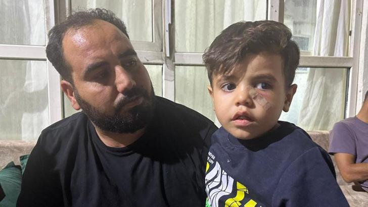 Yorgun mermi, 4 yaşındaki çocuğun gözünün altına isabet etti