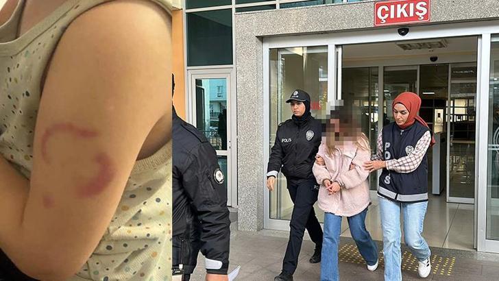 Bakımevinde 3 yaşındaki öğrencisinin kolunu ısıran öğretmen tutuklandı