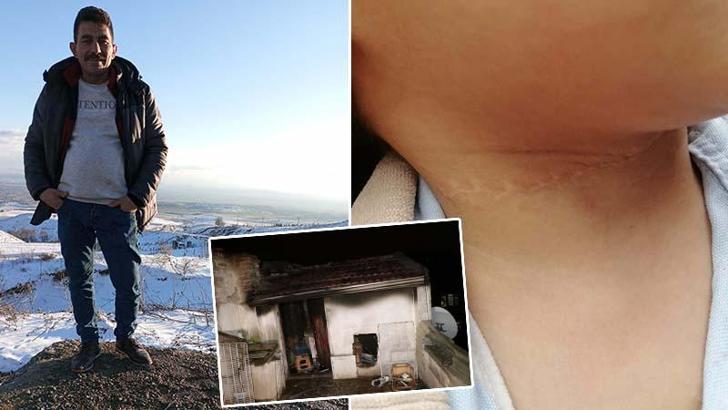 1,5 yaşındaki çocuğun boynunu kesen sanığa 21,5 yıl hapis