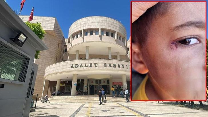 Öğrencinin yüzünde sigara söndüren temizlikçi tutuklandı