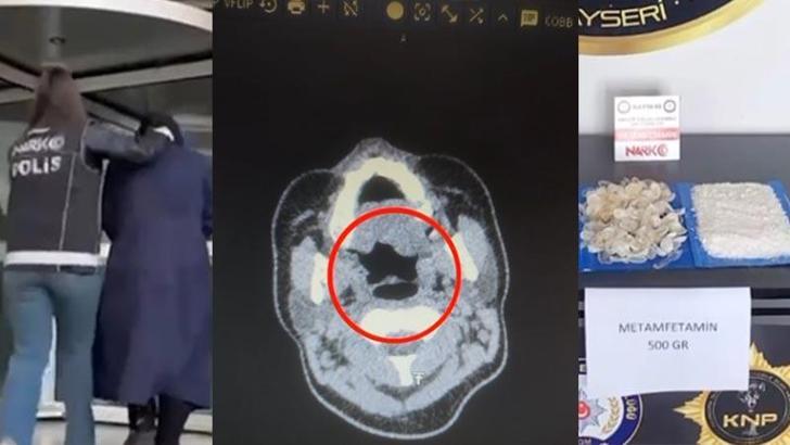 Midesinden yarım kilo metamfetamin çıktı