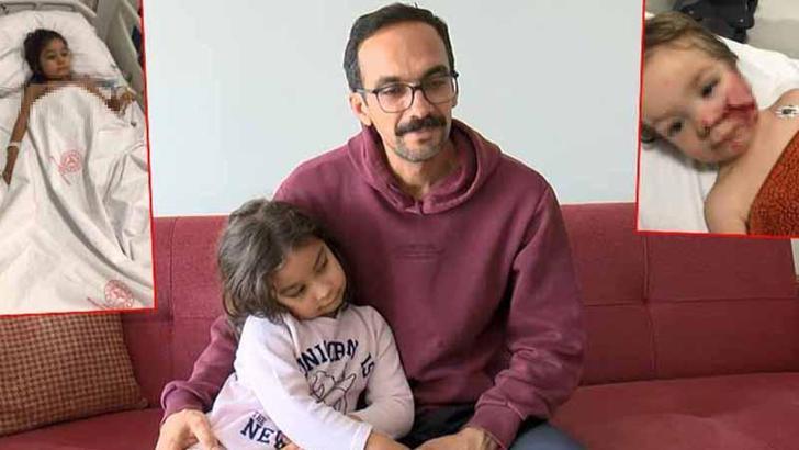 2 kardeşe saldıran pitbull ile ilgili 12 şikayet yapılmış