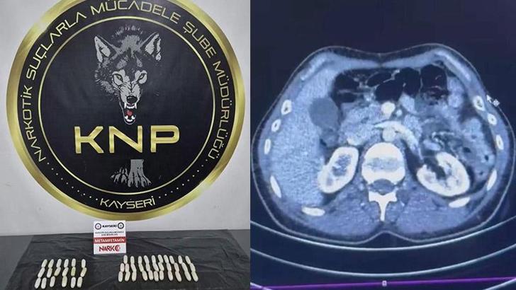 İranlı şüphelilerin midelerinde uyuşturucu tespit edildi; 3 gözaltı