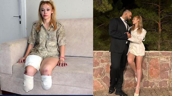 İrem’in bacaklarını kaybettiği kazada TIR şoförü: Arızaya bakmak için indiğimde araç hareket etti