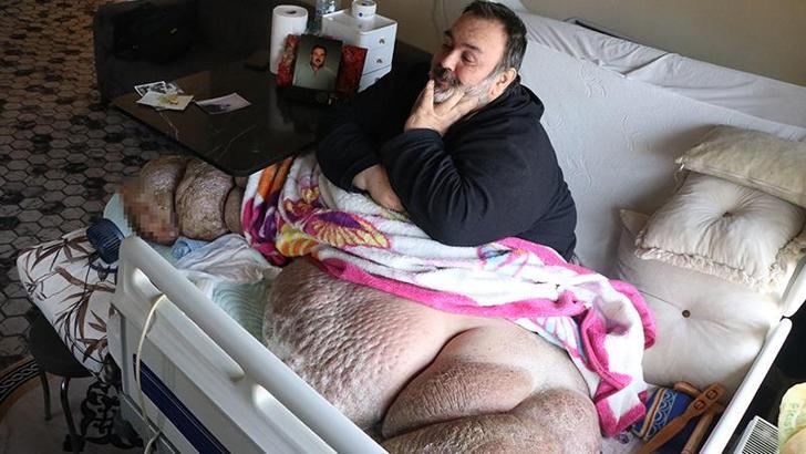 DHA'nın haberi sonrası fil hastası babaya yardım eli