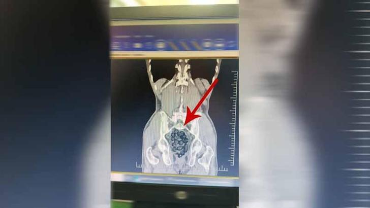 Yolcunun midesinden 472 gram metamfetamin çıktı