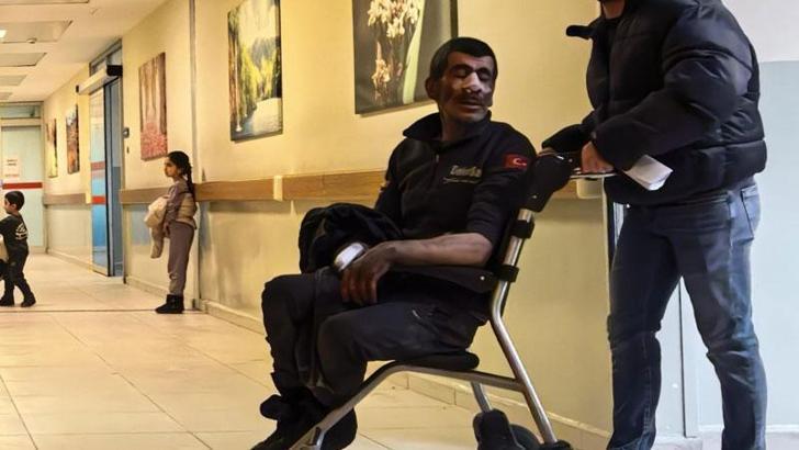 Tamir sırasında hava bastığı lastik patlayınca yaralandı