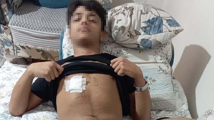 Eski sevgilisiyle yazıştığı akranı ve onun arkadaşları tarafından dövülüp, bıçaklandı