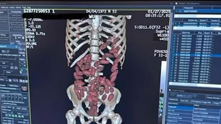 İstanbul- 2025’te İstanbul Havalimanı’nda ‘yutucu’ kuryelerden 29,7 kilo uyuşturucu ele geçirildi