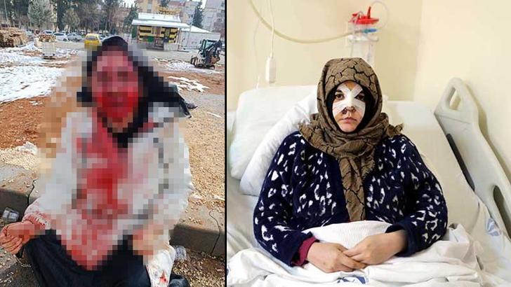 Eşinin kaldırım taşı ile dövdüğü Nazlı: Çıkarsa yarım bıraktığı işi tamamlar