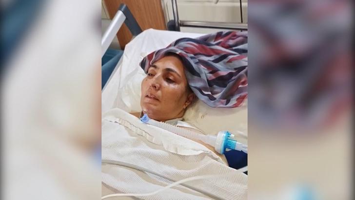 Eşinin dövüp, olayı kaza gibi göstermeye çalıştığı kadın, 54 gündür yoğun bakımda
