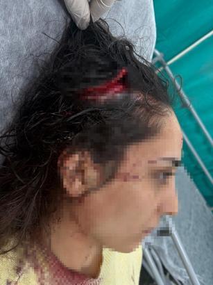 Bakkala giderken sokak köpeklerinin saldırısında yaralandı